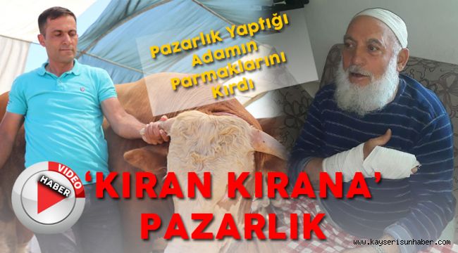 Pazarlık Ettiği Adamın Parmaklarını Kırdı  