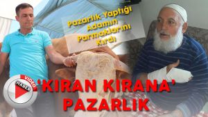 Pazarlık Ettiği Adamın Parmaklarını Kırdı  