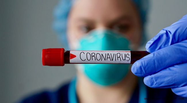 İspanya'da son 24 saatte 410 kişi koronavirüsten öldü