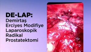 ERÜ'den Prostat Kanseri Tedavisinde Yerli Ve Milli Tedavi Yöntem: DE-LAP