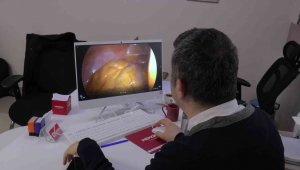 Hastalar için kolay tedavi: "Laparoskopik Cerrahi"