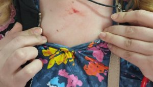 65 yaşındaki kadın sağlık çalışanını boğazından yaraladı