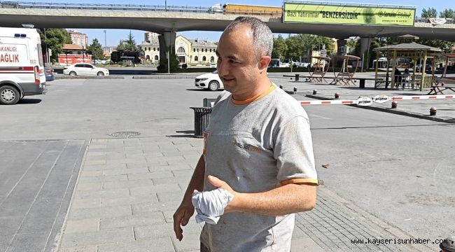 Kayseri'de 420 acemi kasap hastanelere başvurdu