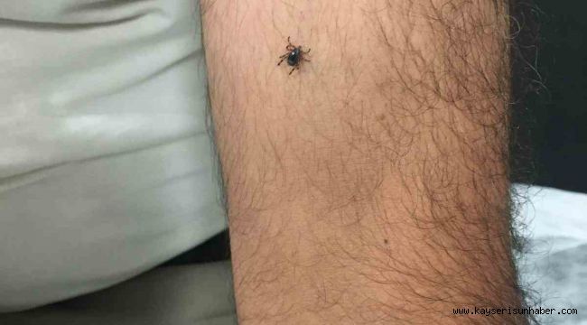 Kayseri'nin bir ilçesinde daha kene vakası