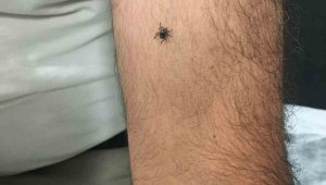 Kayseri'nin bir ilçesinde daha kene vakası